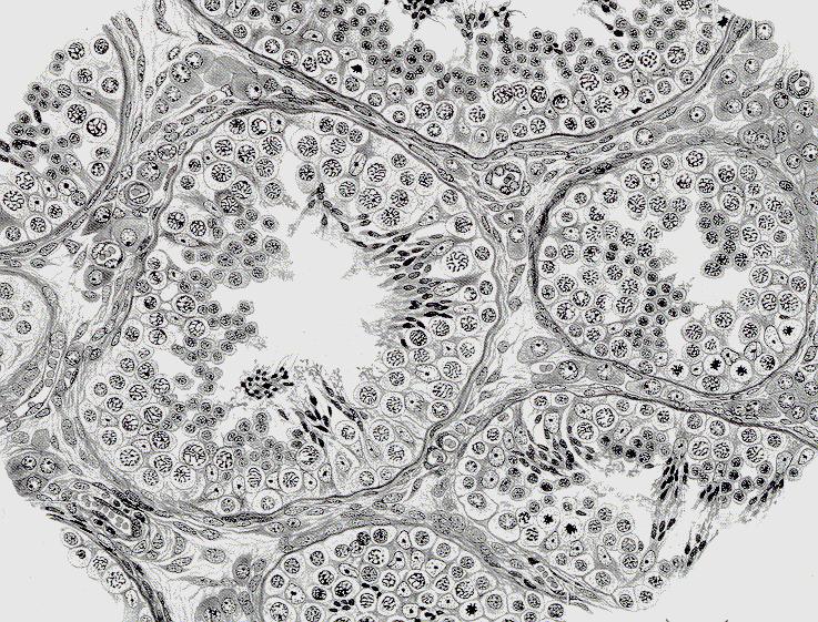 Sertoli cells 
