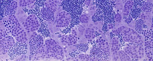 Sertoli Non-Cystic Sertoli cells contact germ cells in