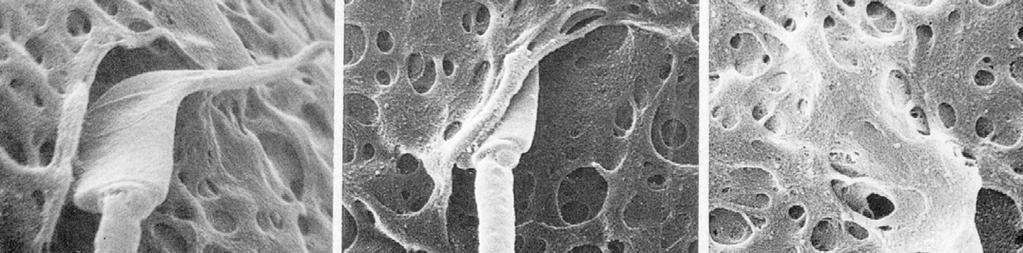 radiata granulosa cells; cutting
