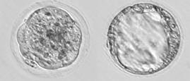 Perform embryo transfer Imagine Innovate Integrate Insert NSET through