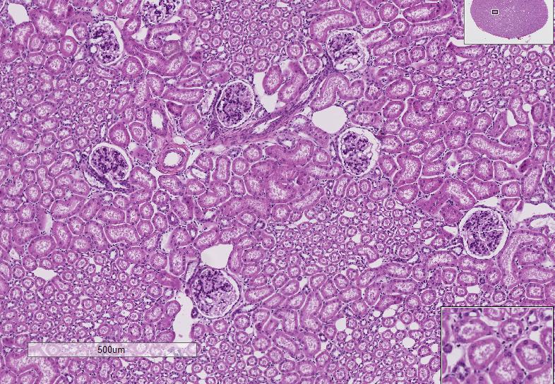 renal corpuscles; proximal and distal Slide #104(20kK G).