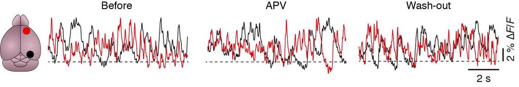 Supplementary Figure 13 The glutamate receptor antagonist APV has no effect on impaired slow-wave activity in APP23 PS45 mice.