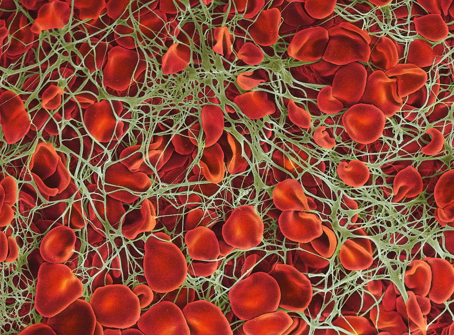 PROTECTION: Platelets Begin the process of blood clotting by releasing