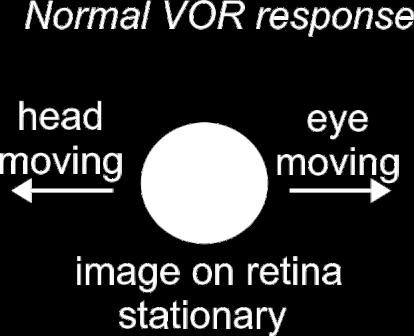 Why do we get dizzy? During normal head rotations, the eye rotates opposite to the head, thus canceling the motion of the head. This tends to stabilize the image of the world on retina.