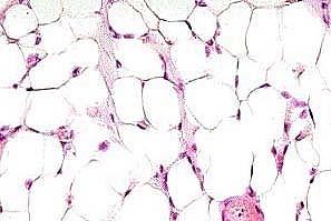 Adipose tissue has no specific matrix and contains large number of fat