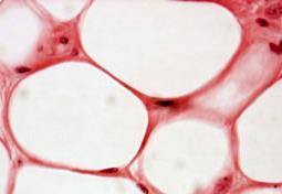 5- Adipose Cells (Adipocytes, Fat Cells) L/M of Unilocular Adipose Cells: Large spherical, with a single large