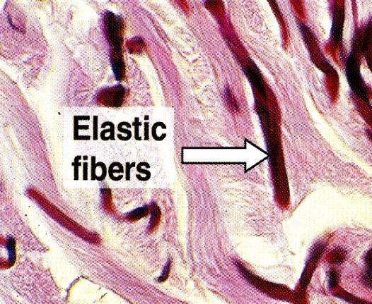 Stained black with silver. Other important types of collagen include: type II (in cartilage).