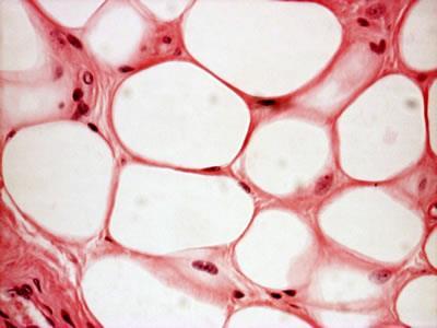 V- UNILOCULAR ADIPOSE TISSUE (WHITE ADIPOSE TISSUE) L/M: Predominance of unilocular fat cells.