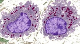 2- Macrophages L/M: Basophilic cytoplasm, rich in lysosomes.