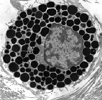 L/M: 3- Mast Cells Cytoplasm contains
