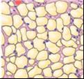 2. Adipose (FAT) Structure: Fibroblasts enlarge and store fat, very little matrix Functions: stores energy, insulates and