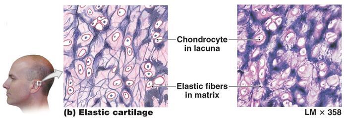 2. Elastic Cartilage Elastic fibers in addition