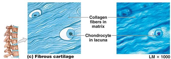 3. Fibrous Cartilage (fibrocartilage) Very tough, large numerous collagen
