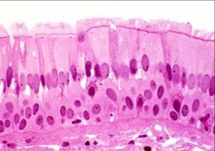 Pseudostratified Columnar -Nuclei are uneven which gives it a layered appearance but