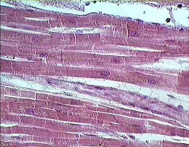 Cardiac Muscle -forms the bulk of the wall of the heart.