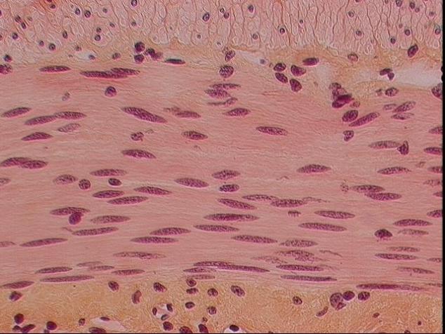 Smooth muscle- located in the walls of hollow internal structures Internal structures such as: Blood vessels