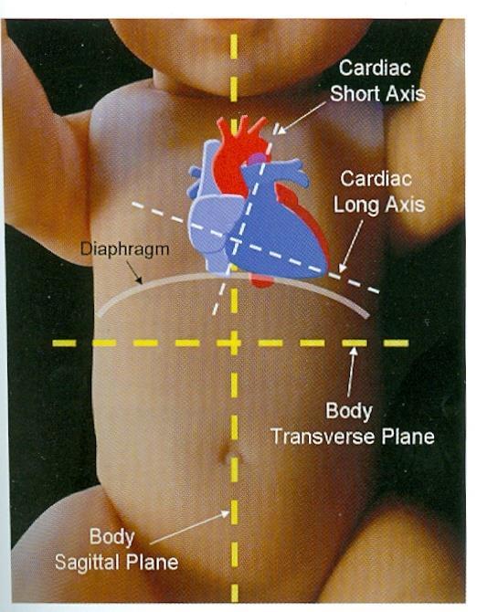 Fetal cardiac