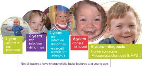 X linked Recessive Disease Hunter syndrome is a genetic disorder that primarily affects males.