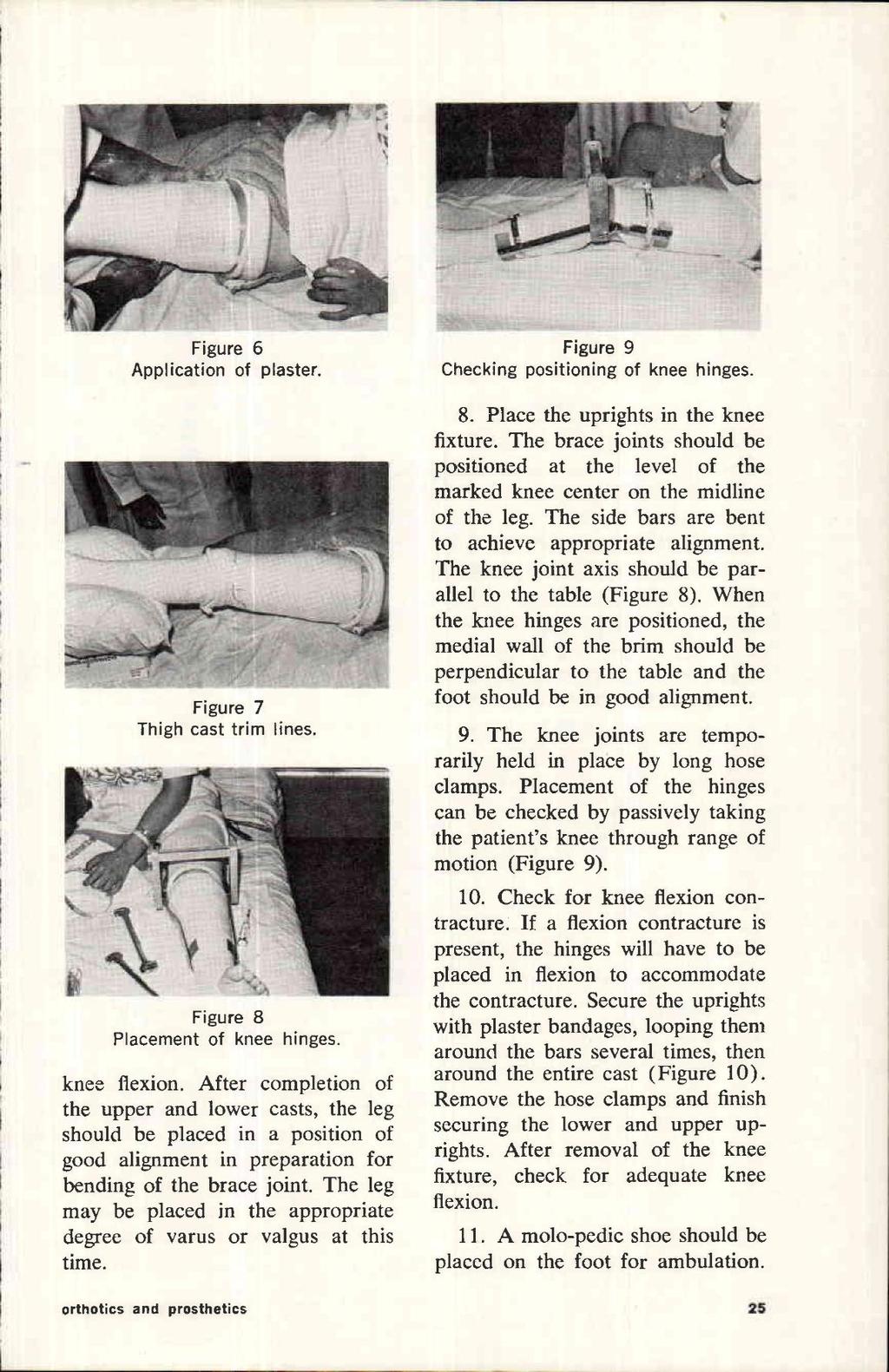 Figure 6 Application of plaster. Figure 7 Thigh cast trim lines. Figure 8 Placement of knee hinges. knee flexion.