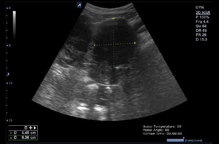 Gynecology Imaging E-CUBE 7, adds more values.