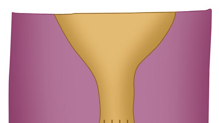 Development of Gastrointestinal Tract 123 toward the cloacal membrane. It has fork-like extensions which produce infoldings of the lateral walls (Rathke s folds) of the cloaca.