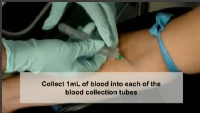 Shaking of Tubes Blood Incubation