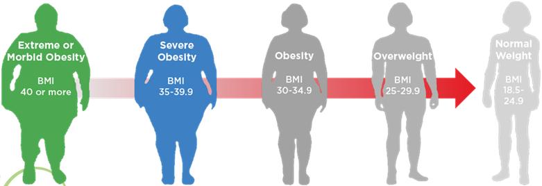 Defining Obesity Normal Weight (BMI 18.5 to 24.9) Overweight (BMI 25 to 29.9) Obese (BMI 30 to 34.9) Severely Obese (BMI 35 to 39.