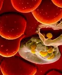 AIDS disease HIV makes the body's immune