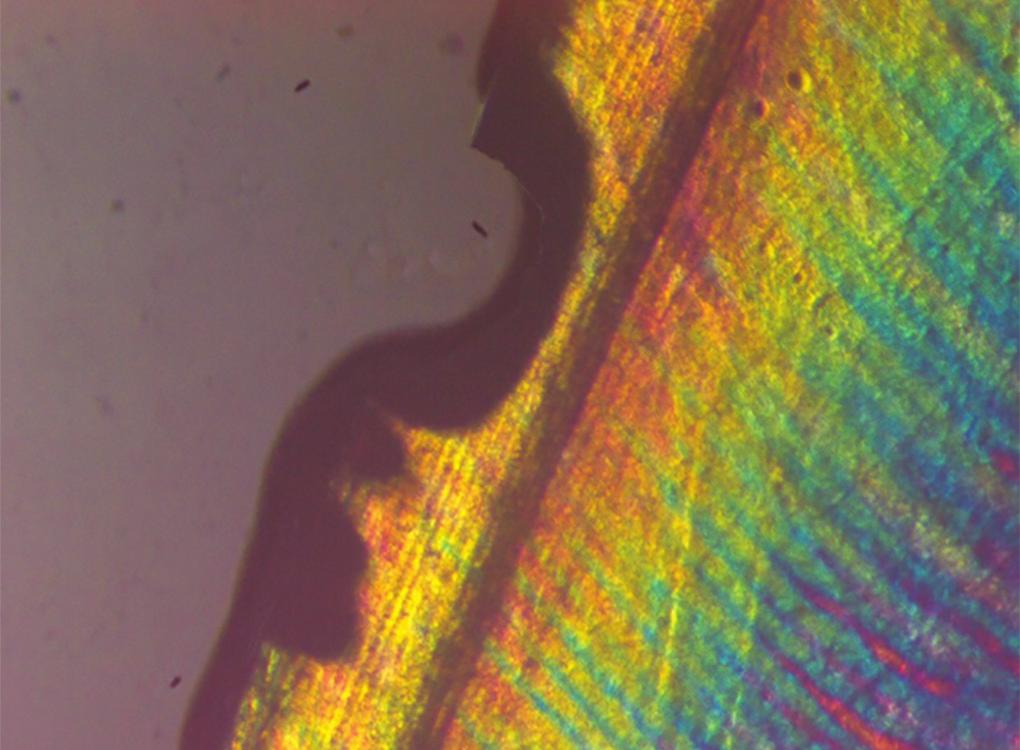 6: Polarized light microscopy image of representative lesion from the group