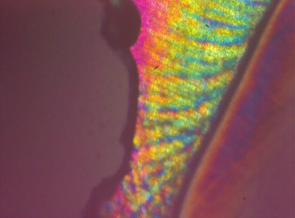 7: Polarized light microscopy image of representative lesion from the group