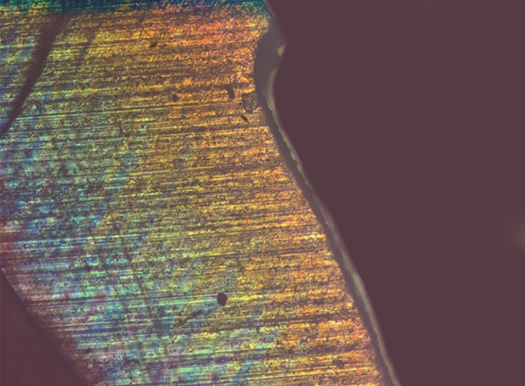 10: Polarized light microscopy image showing image depth analysis using Image J software as fluoride, casein phosphopeptide amorphous calcium phosphate (CPP-ACP) and bioavailable calcium phosphate.