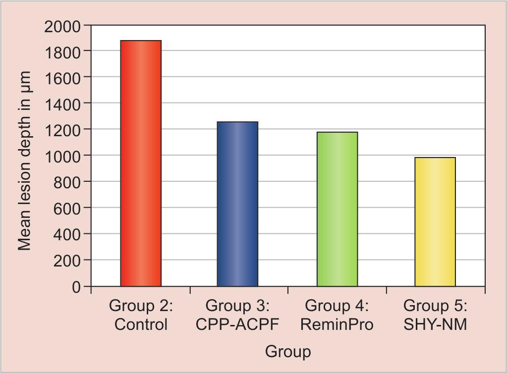 Reshma Rajan et al Table 1: Intergroup comparison of lesion depth after remineralization with fluoridated toothpaste, CPP-ACPF, ReminPro and SHY-NM Groups N Mean lesion depth in μm SD F p-value
