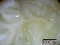 A second study was conducted to look at the microleakage or dye penetration of extracted molars treated with the Adhesive and Clinpro Sealant.