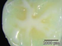 Following the dye immersion, the samples were removed, rinsed and high magnification images were taken to evaluate the margins for any dye penetration or