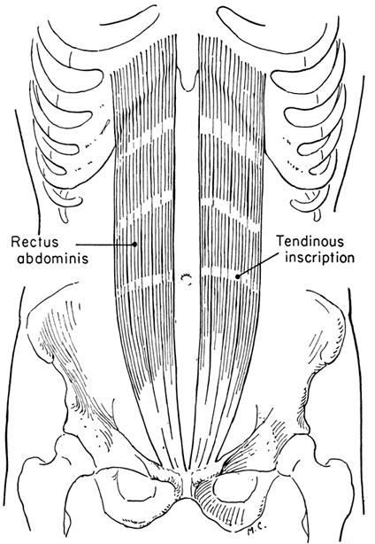 MUSCLES OPERATING SPINAL COLUMN Rectus Abdominis Function: Singly: