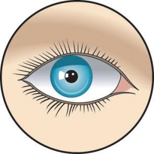 Emergency procedures Know First Aid for MDI Force open the eyelids Flush with lots of water for at least 15 minutes If in doubt, keep flushing See eye specialist as soon