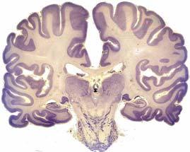 brain: ) Lateral Geniculate nucleus ) Superior Colliculus 3) Hypothahalamus 4) Pretectum The