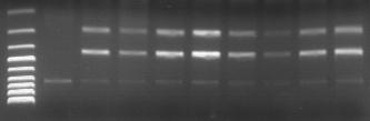 Electrophoresis of the RT/PCR products after digestion with the