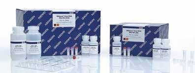 QIAamp virus kits For purification of viral DNA and RNA from a wide range of sample materials Automatable on QIAGEN s proven QIAamp Kits set the standard for purification of viral DNA and RNA.