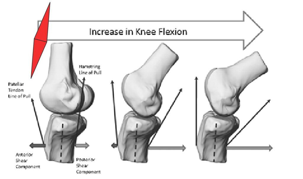 Bad Knee Mechanics At small knee flexion angles (0-40 ): Quadriceps contraction translates into greater anterior shear