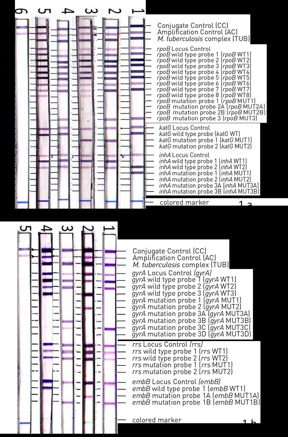 Figure 1. 1a. Examples of GenoTypeMTDBRplus strips (Hain Lifescience, Nehren, Germany). (Lane 1) Multidrugresistant tuberculosis (MDR TB), rpob S531L mutation and inha C15T mutations.