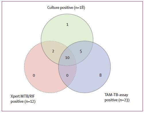 Novel diagnostics: Host biomarkers for TB TAM-TB : Detects activated