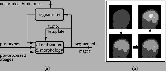 Figure 1: ATmC (Adaptive Template moderated Classification) segmentation scheme (a) and brain tumor segmentation flow diagram (b).