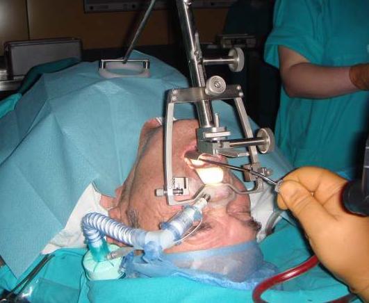 history physical examination inspection and palpation indirect laryngoscopy stroboscopy telescopic laryngoscopy DIRECT LARYNGOSCOPY panendoscopy toluidine test microlaryngoscopy transconicoscopy neck
