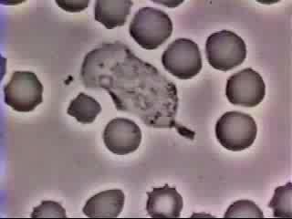 Bacterial Chemoattractant Directs Neutrophil