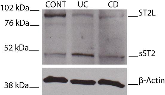 submitted IL-33 expression is increased and ST2L is downregulated in IEC from UC patients