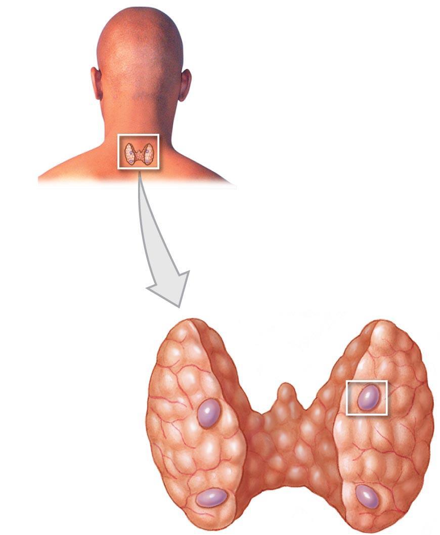 Figure 10-11 The Parathyroid Glands.