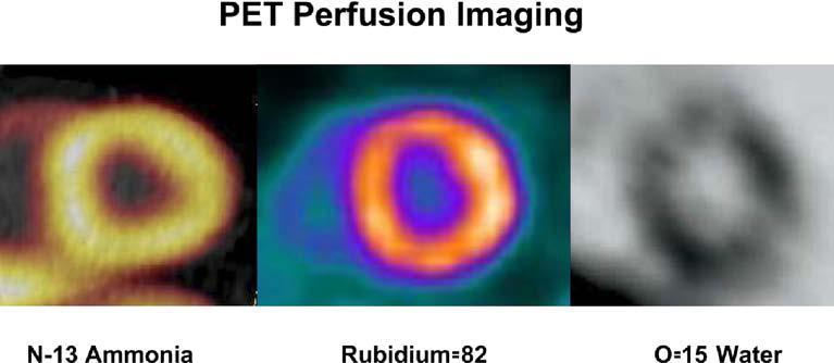 PET Perfusion Imaging