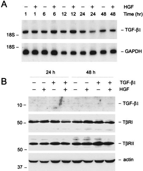 70 Journal of the American Society of Nephrology J Am Soc Nephrol 16: 68 78, 2005 Figure 1. Regulation of TGF- 1 and its receptors by hepatocyte growth factor (HGF) in tubular epithelial cells.