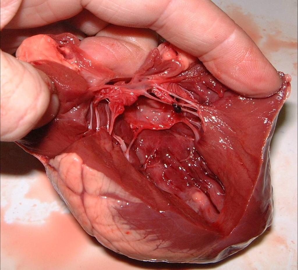 27 The Heart and Blood Vessels.